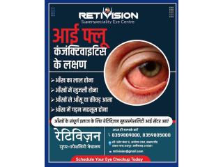 Best eye flu (conjunctivitis) treatment in Retivision Superspeciality Eye Centre.