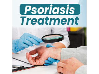 Homeopathic medicine for psoriasis cure(homeopathic treatment)