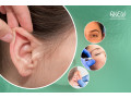 eyebrow-and-ear-cosmetic-surgery-in-bangalore-at-anew-small-0