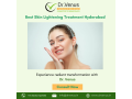 best-skin-lightening-treatment-hyderabad-small-0