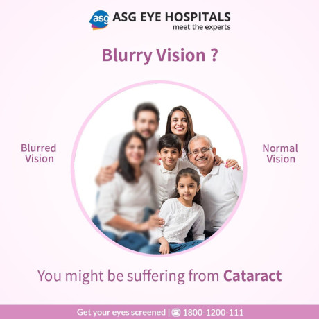 best-eye-care-hospital-eye-specialist-in-india-big-1