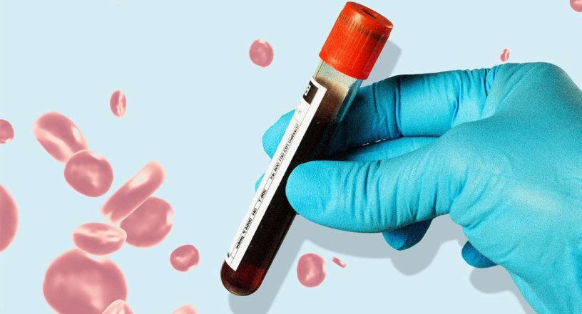 blood-test-delhi-big-0
