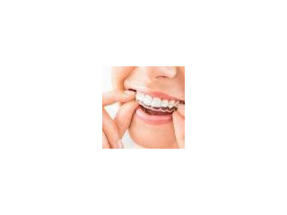 Invisalign Braces Cost in Bangalore - Amaya Dental Clinic