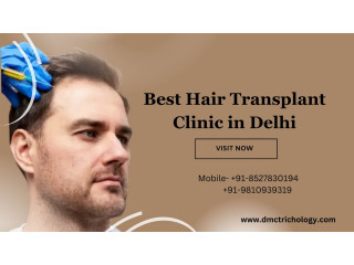 Best Hair Transplant In Delhi