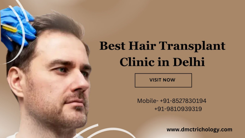 best-hair-transplant-in-delhi-big-0
