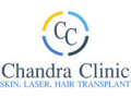 best-hair-transplant-in-delhi-chandra-clinic-small-0