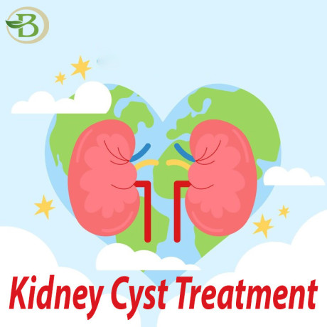 modern-methods-for-treating-and-managing-kidney-cysts-with-renal-resilience-big-0