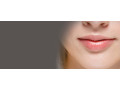 lip-enhancement-in-delhi-small-0